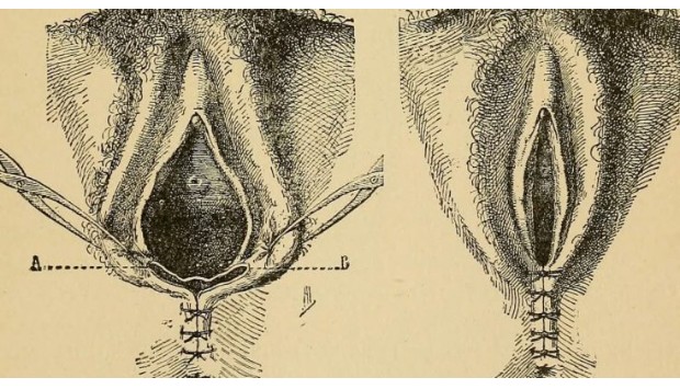 Enital hygiene our tips … see more
